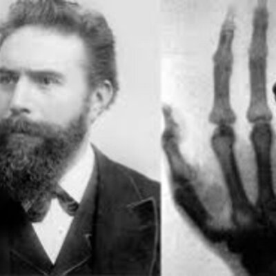 Timeline: Historia y desarrollo de la Radiología