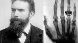 Timeline: Historia y desarrollo de la Radiología