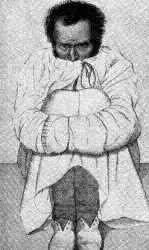 LAS TEORÍAS ANATOMOPATOLÓGICAS DE LA LOCURA: ANTECEDENTES Y DESARROLLO