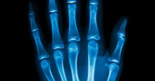 Avances con la revolución digital