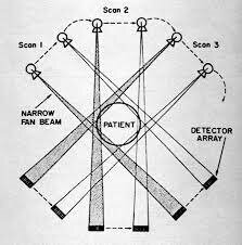 SEGUNDA GENERACION DE TAC