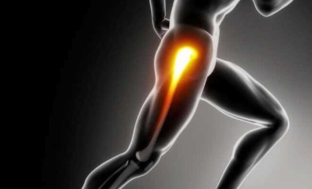 ¿QUÉ ES UN TENDÓN?