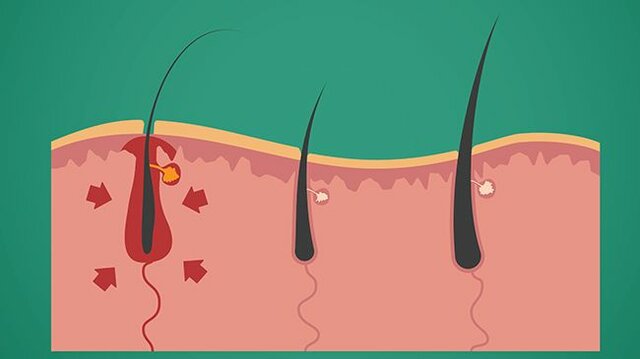 Victor Balthazard (1872-1950)