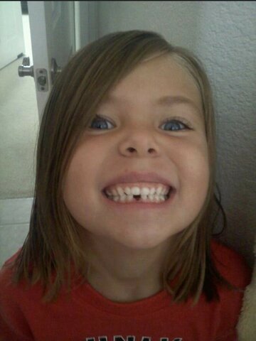 Lost my first tooth :)