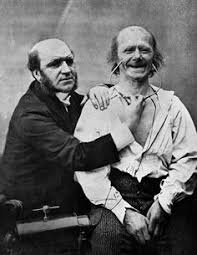 Duchenne y su descripción de la sonrisa