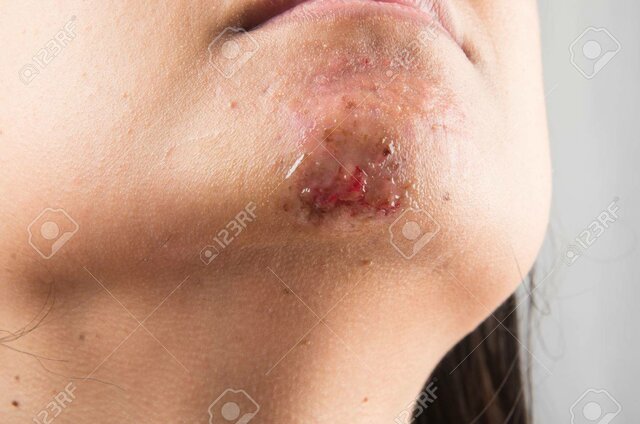 Em vaig obrir la barbeta