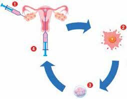 Primera fecundación in vitro humana.