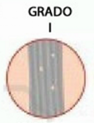 Grado I.