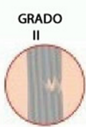 Grado II