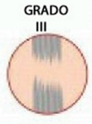 Grado 3