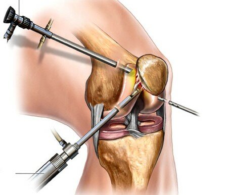 Tratamiento quirúrgico