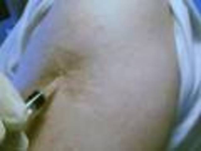 Development of smallpox vaccine- Edward Jenner invented the vaccine for smallpox