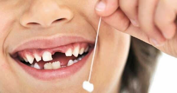 Em cau la primera dent