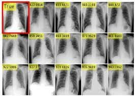 Four second dental match