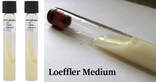 Caldo nutritivo Loeffler