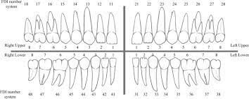 Four second dental matching system