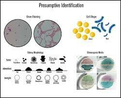 Microbe Identification