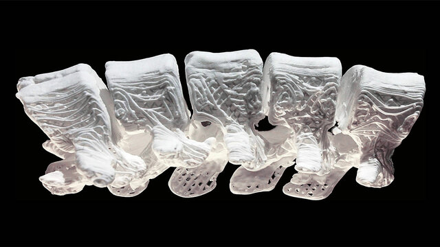 3D printing used to recreate bone fragments