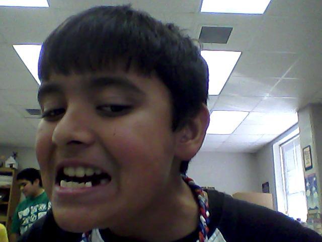 Lost a silver tooth