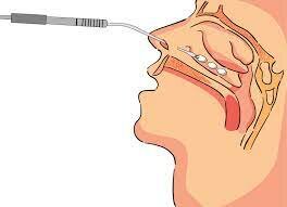 Operació del carnots