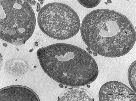 microscopie électronique à transmission de Max Knoll et Ernst Ruska