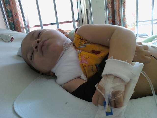 Ma première opération