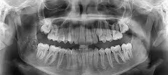 4-Second Dental Match