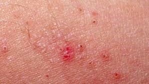 Hecho más Relevante del Humanismo Exótico (1850)