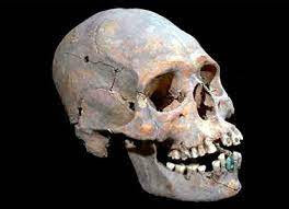 Los mayas y los implantes dentales