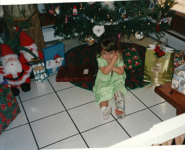 Cuando me rompí mi pierna