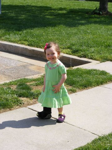 Me rompí la pierna.