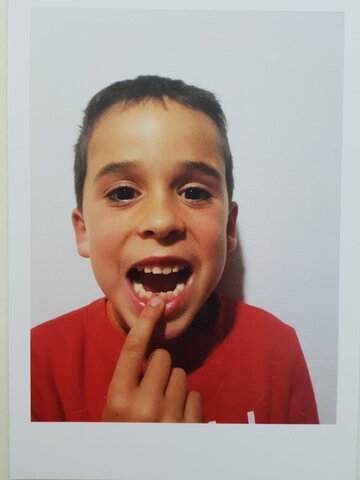 Em cau la primera dent