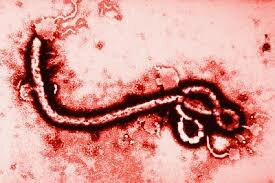 Ebola