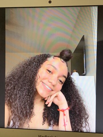 Tuve frenillos por primera vez