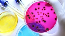 Timeline: Línea del tiempo de la microbiología