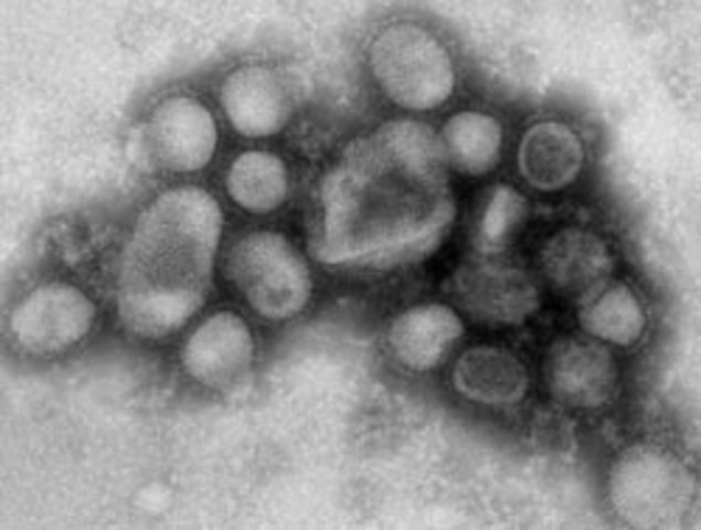 Flu a factor in death of Alberta woman