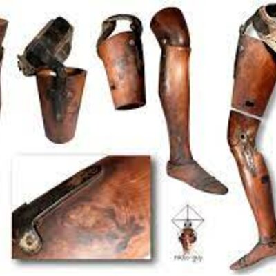 Timeline: LA PROTESSIS