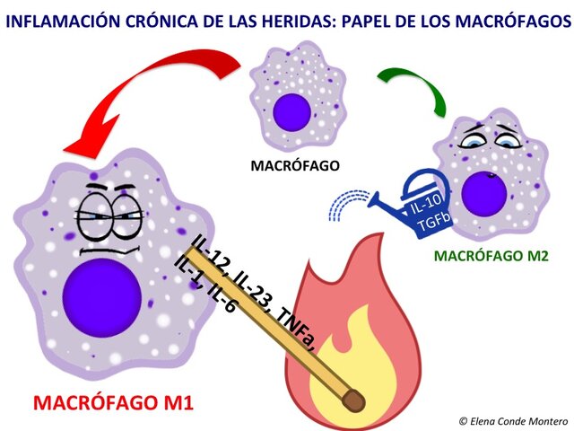 Inflamación crónica- Macrófagos