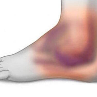 Timeline: Información