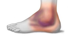 Timeline: Información