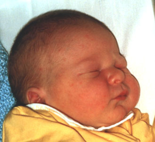 Bruna ganhou um irmão