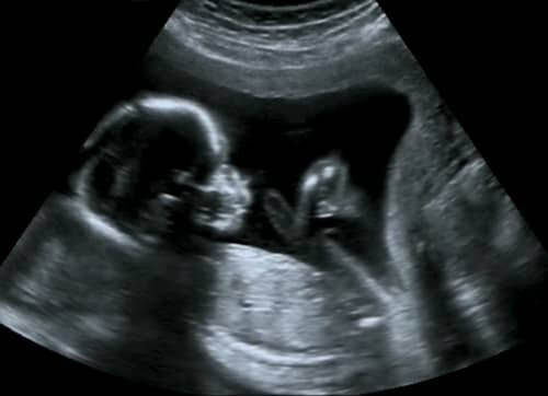 2nd Trimester