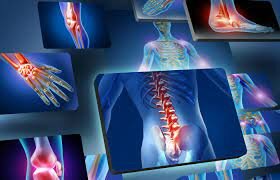 Inflamación Subaguda