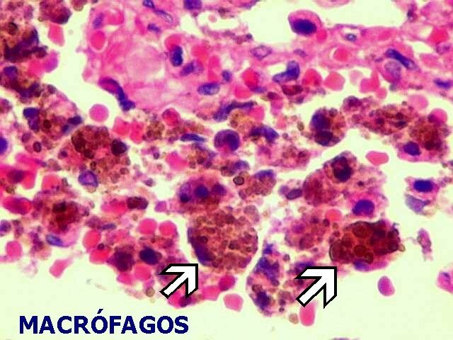 Macrófagos