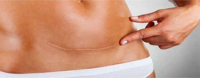 Evolución de la inflamación