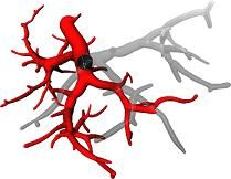 Factores que afectan el proceso de curación