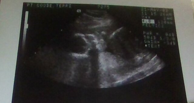 Second trimester-5 months- Starting to kick