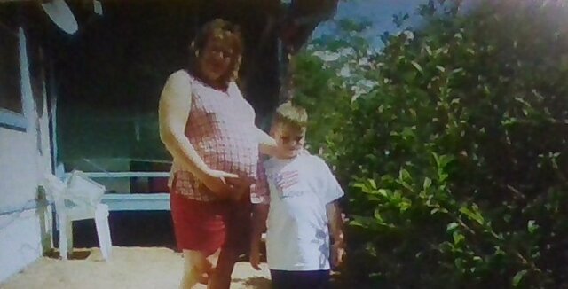 Third Trimester- Preeclampsia-8 months