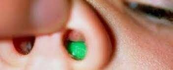 I put one thing of rubber in my nose