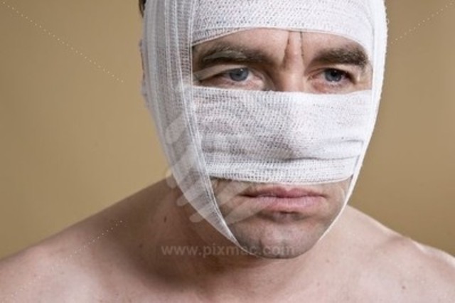 1º operación estética